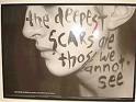 the-deepest-scars-are-those-we-cannot-see.jpg